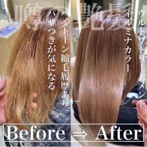 ウルトワトリートメント